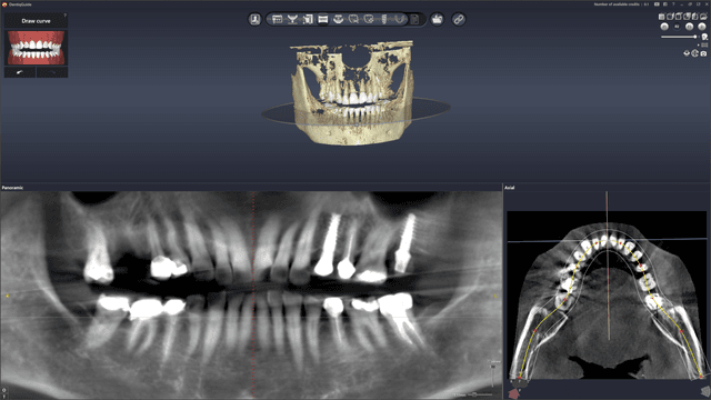 Panoramic Reconstruction