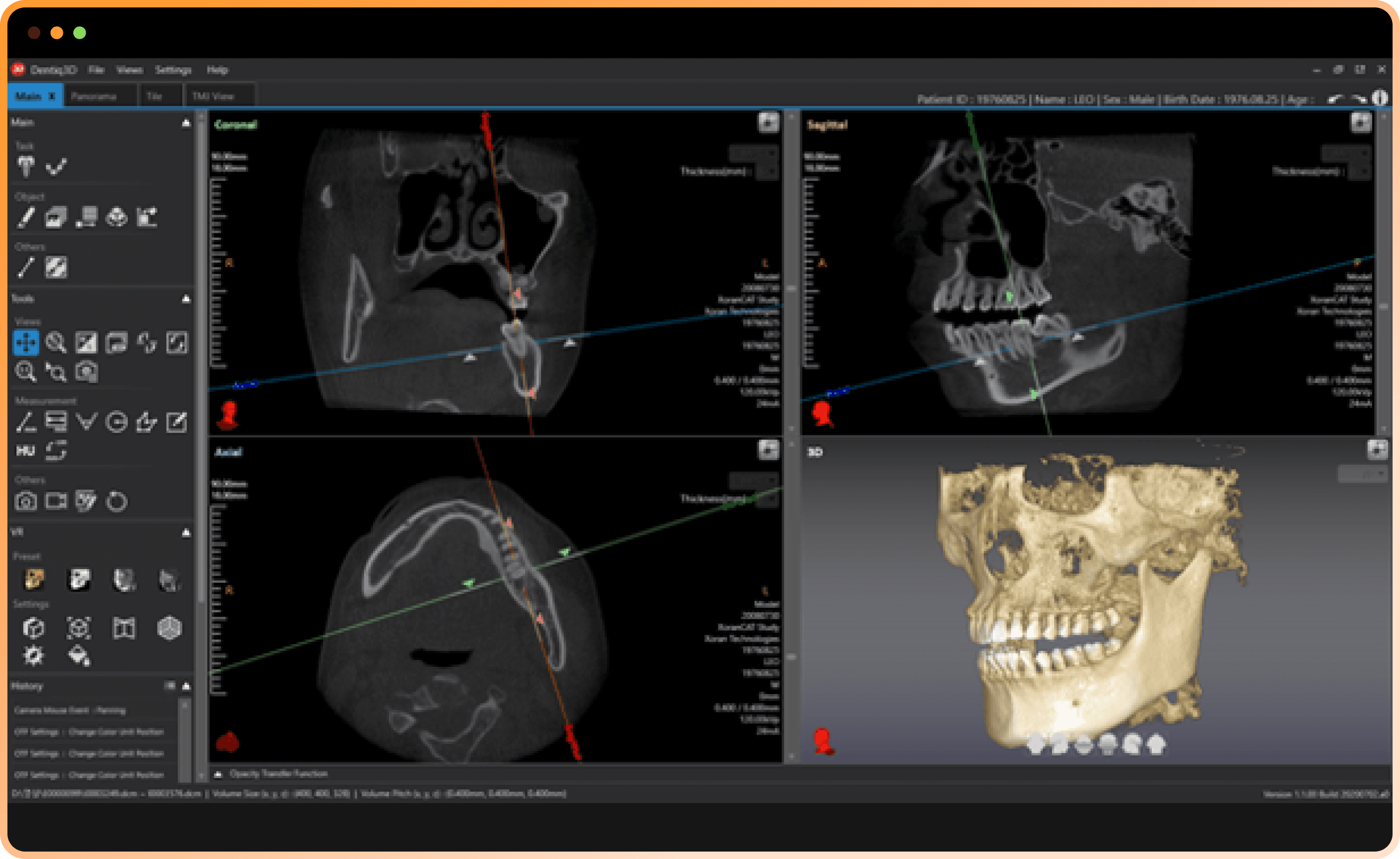 Dentiq3D Software Interface