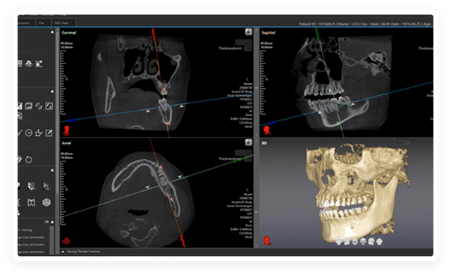 Multi Planar Reformation
