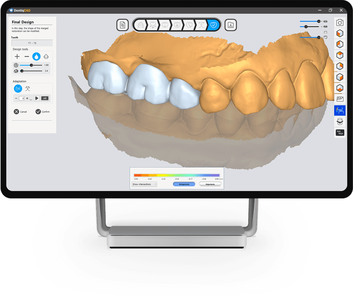 DentiqLink Interface